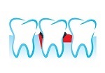 Gum Disease in Downtown Toronto